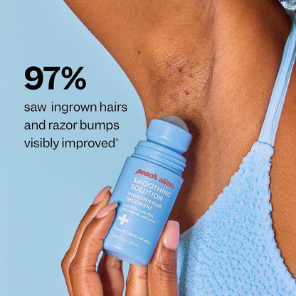 💝 Limited Time 49% OFF 🎇Peach Slices Smoothing Solution Ingrown Hair Treatmen
