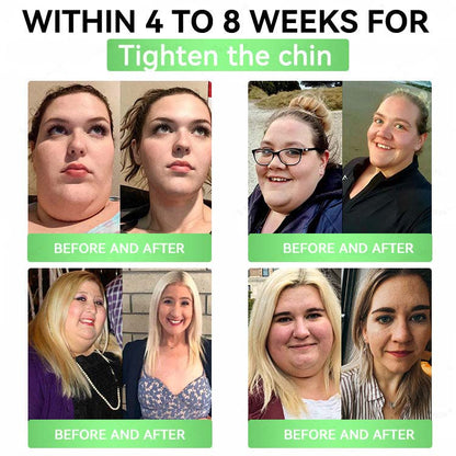 🔥 Vilnexa™ 8-in-1 AMPK Metabolic Slimming Patch 🇺🇸 Moringa × Berberine Formula · Supports Weight Management, Metabolic Balance & Daily Comfort