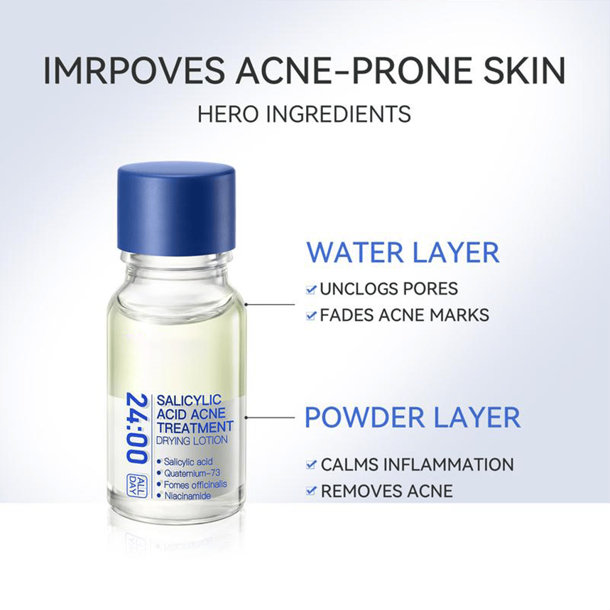 🏆1 Bestselling🏆24H Spot Rescue Acne Lotion (Salicylic Acid+Sulfur+Niacinamide)|for Oily & Acne-Prone Skin|Viral Pimple Fix