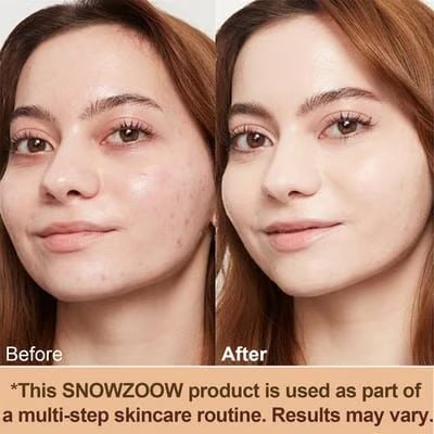 🔥Last Day Sale 49% OFF🎁 Nature - Inspired Foundation 4 in 1 - Medium Spectrum