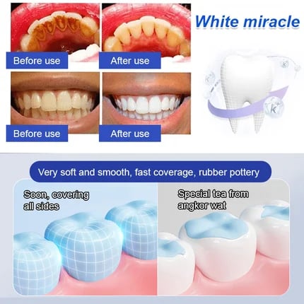 🔥2025 Upgraded Nano-Hydroxyapatite 7.5% Fluoride-Free Restorative Oral Care Toothpaste