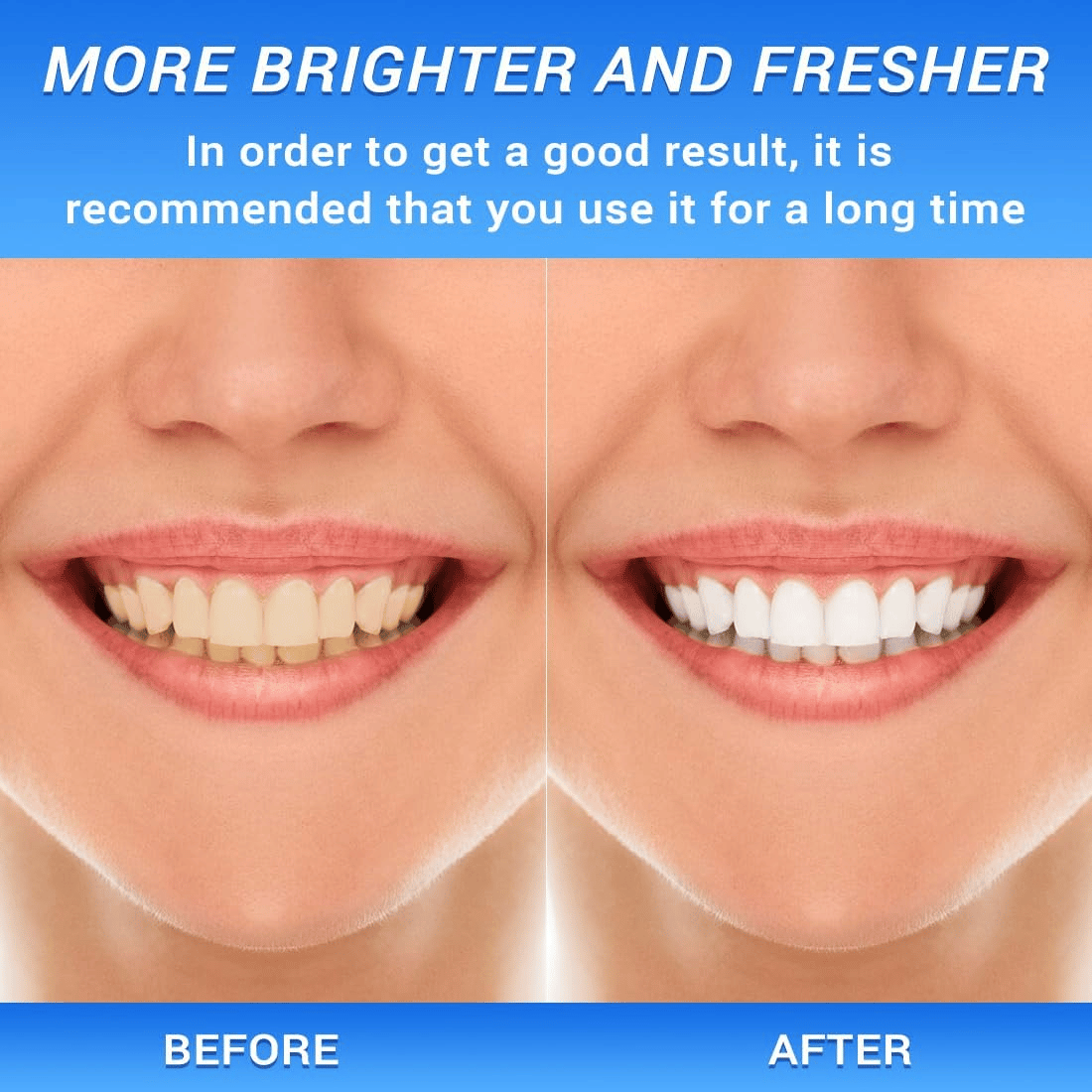 🎁Last Day 49%🎁BodyAccel [Triple Whitening]Niacinamide Fresh Breath Whitening Toothpaste
