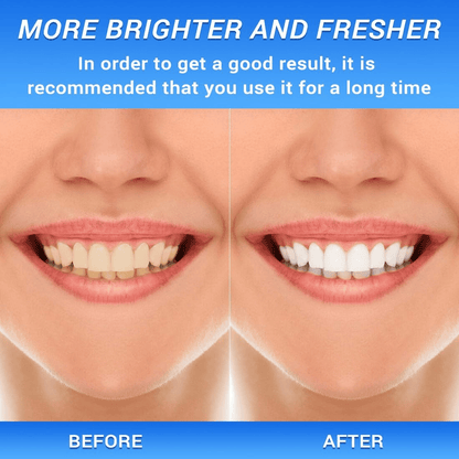 🎁Last Day 49%🎁BodyAccel [Triple Whitening]Niacinamide Fresh Breath Whitening Toothpaste