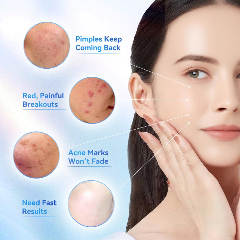 🏆1 Bestselling🏆24H Spot Rescue Acne Lotion (Salicylic Acid+Sulfur+Niacinamide)|for Oily & Acne-Prone Skin|Viral Pimple Fix