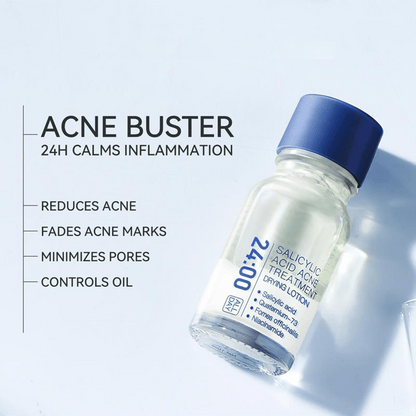 🏆1 Bestselling🏆24H Spot Rescue Acne Lotion (Salicylic Acid+Sulfur+Niacinamide)|for Oily & Acne-Prone Skin|Viral Pimple Fix