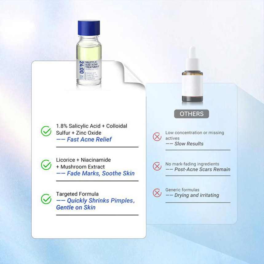 🏆1 Bestselling🏆24H Spot Rescue Acne Lotion (Salicylic Acid+Sulfur+Niacinamide)|for Oily & Acne-Prone Skin|Viral Pimple Fix