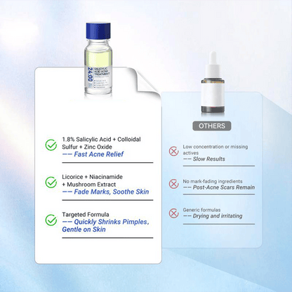 🏆1 Bestselling🏆24H Spot Rescue Acne Lotion (Salicylic Acid+Sulfur+Niacinamide)|for Oily & Acne-Prone Skin|Viral Pimple Fix