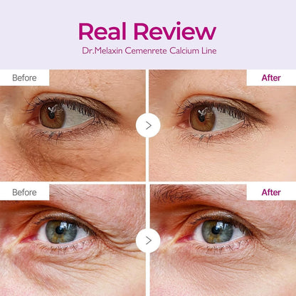 💕Hot sale 49% OFF💖✨ Calcium Volume Multi Balm + Eye Patch Set (60ea)